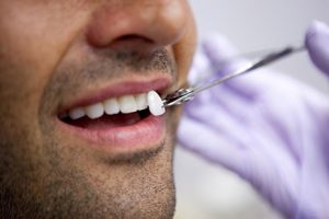 Lente dental em Ponte Nova